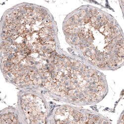 SERINC5 Antibody, Novus Biologicals 25 &mu;L, Unlabeled:Antibodies, Polyclonal